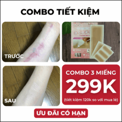 Miếng dán che sẹo Sakura Nhật Bản nhiều size, nhiều màu