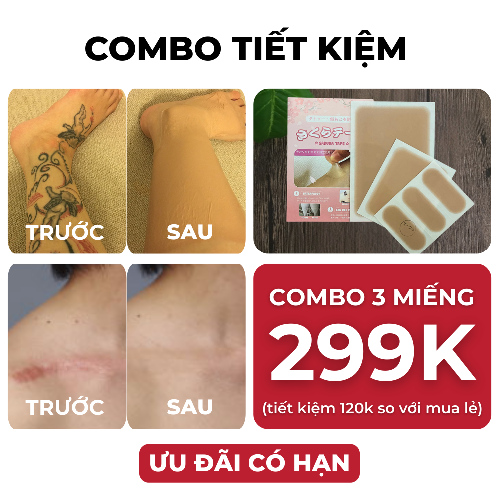 xăm sẹo tổng hợp